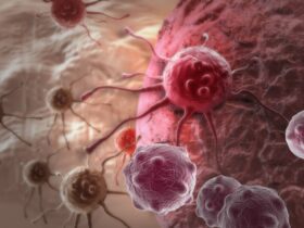 Surviving most cancers may also rely upon wherein you live inside the global 46 Surviving most cancers may also rely upon wherein you live inside the global 45