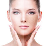 Treating Pigmentation: Serums and Solutions 40