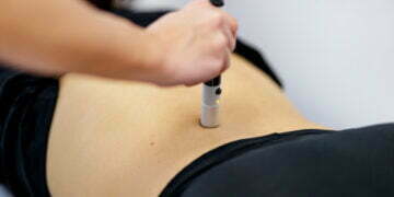 Benefits of Using Laser Therapy To Treat Sciatica For Quick Recovery