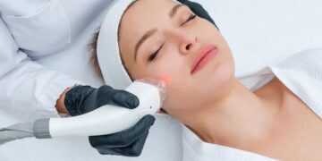 Laser Treatment for Acne: What You Need to Know Before You Go