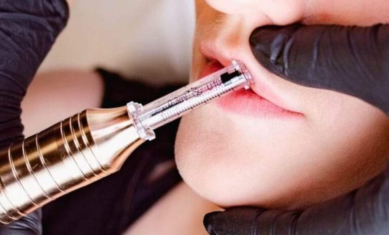 Plump Your Pout: Hyaluron Pen Lip Filler 7