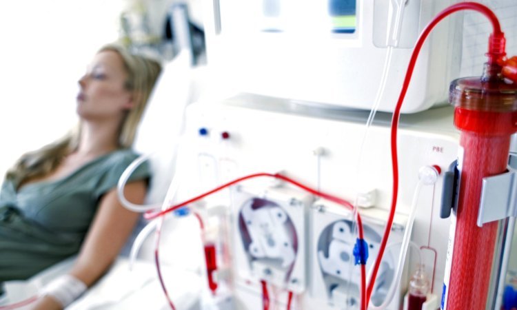 Kidney Dialysis Life Expectancy 10