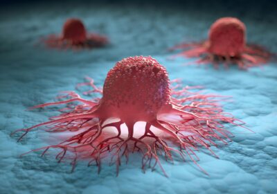Cancer Awareness Campaign Ideas that Convert in 5 Minutes or Less 99