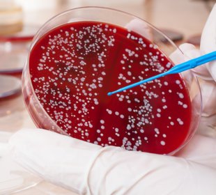 New hope for blood cancer sufferers to discover a matching blood stem mobile donor 5