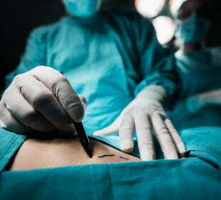 The 19 Things I Always Recommend to Someone Having Breast-Cancer Surgery 1 The 19 Things I Always Recommend to Someone Having Breast-Cancer Surgery 1