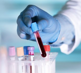 Liquid biopsies: the future of cancer prognosis? 8