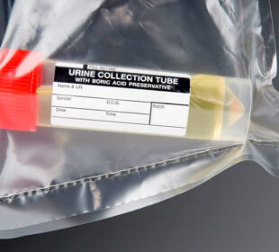 The Best Drug Test Urine Results Software 8