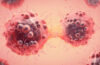 Prostate Cancer News - How to Get the Latest News on This Condition 10